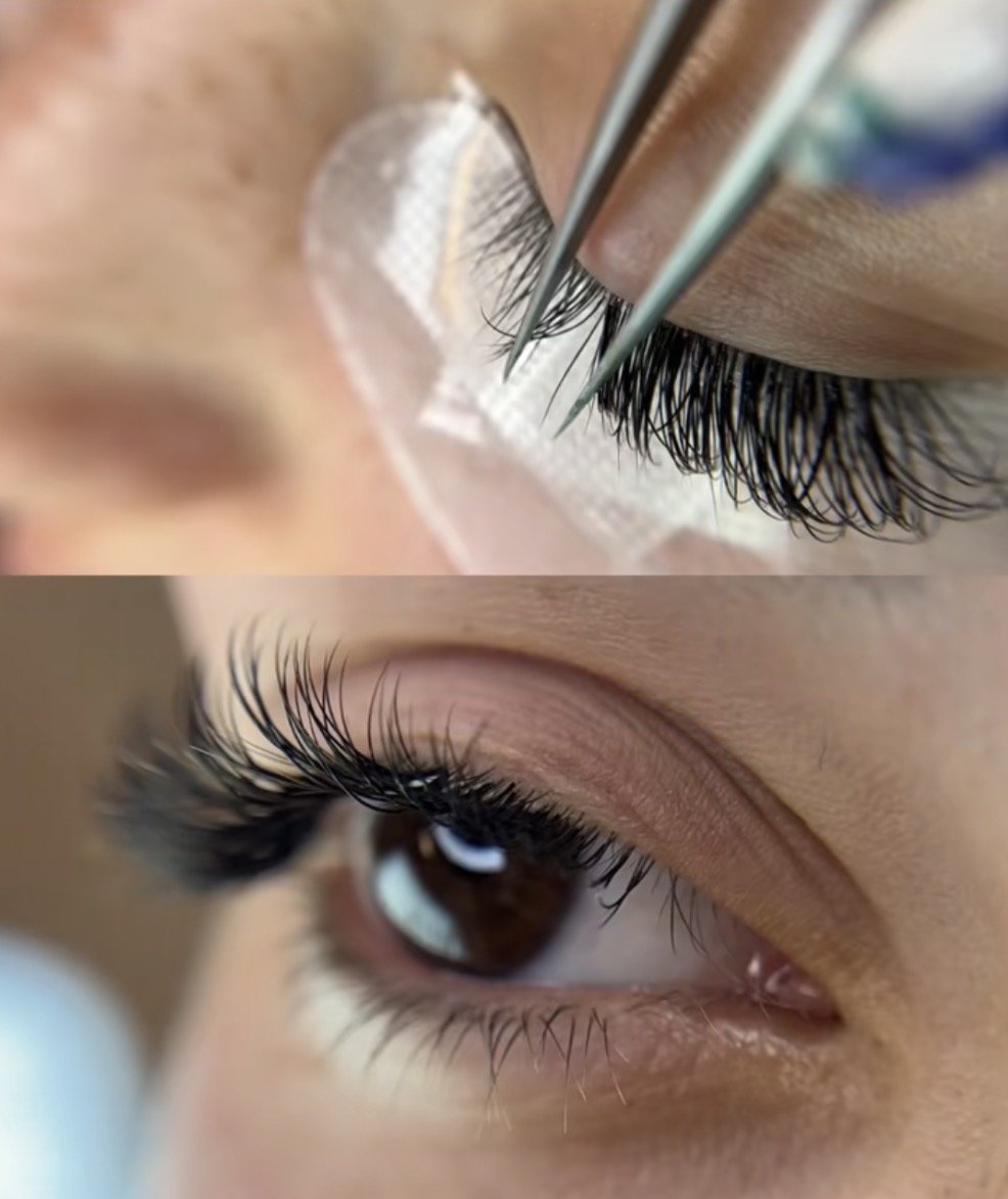Before & After